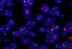 RUO Onco-Haematology FISH Probe Kits
